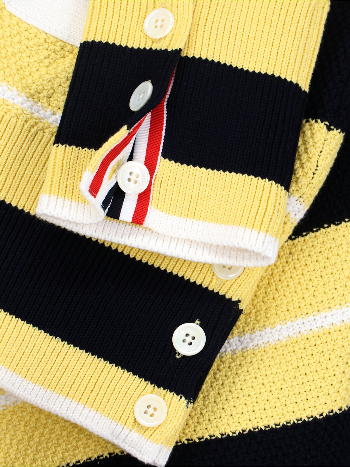 Striped Cardigan – Yellow