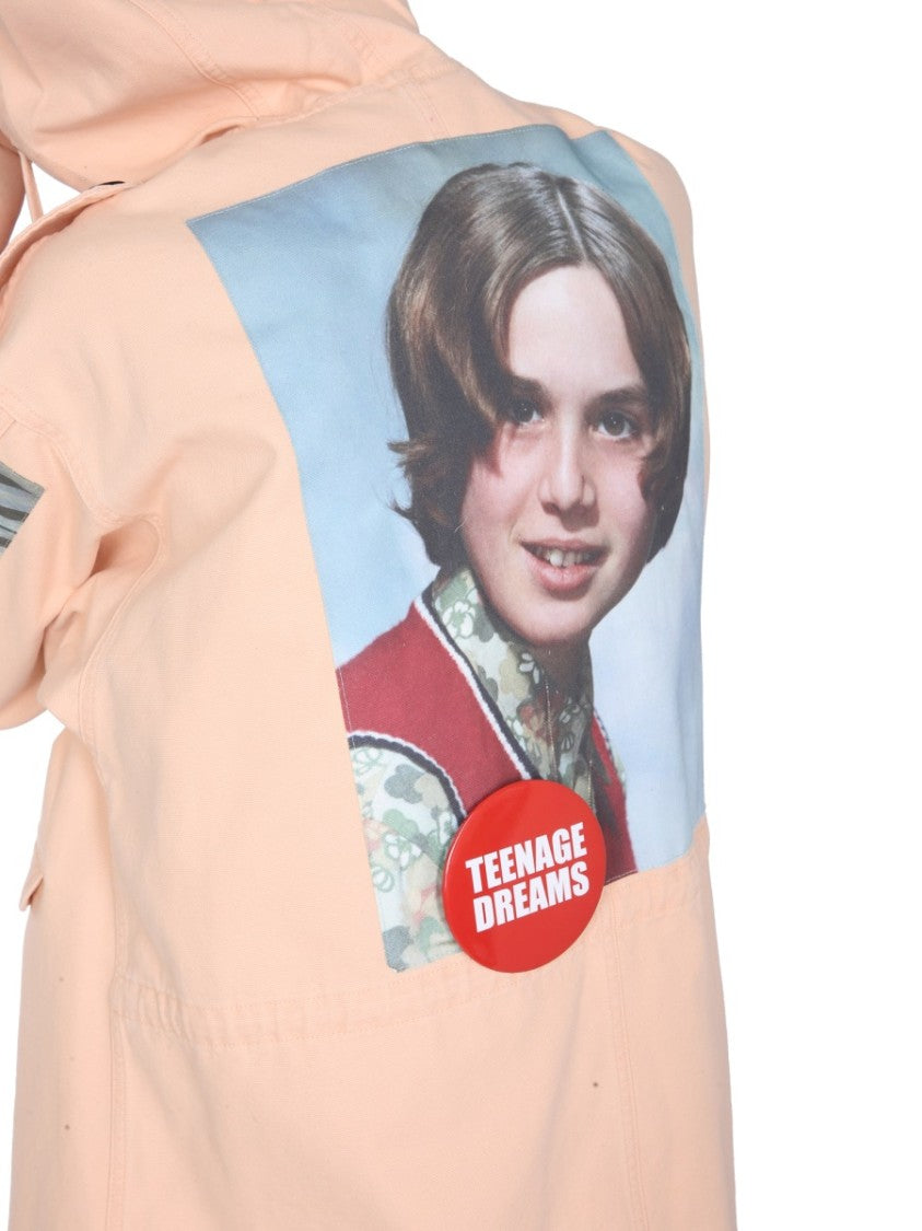 Concealed Button Parka