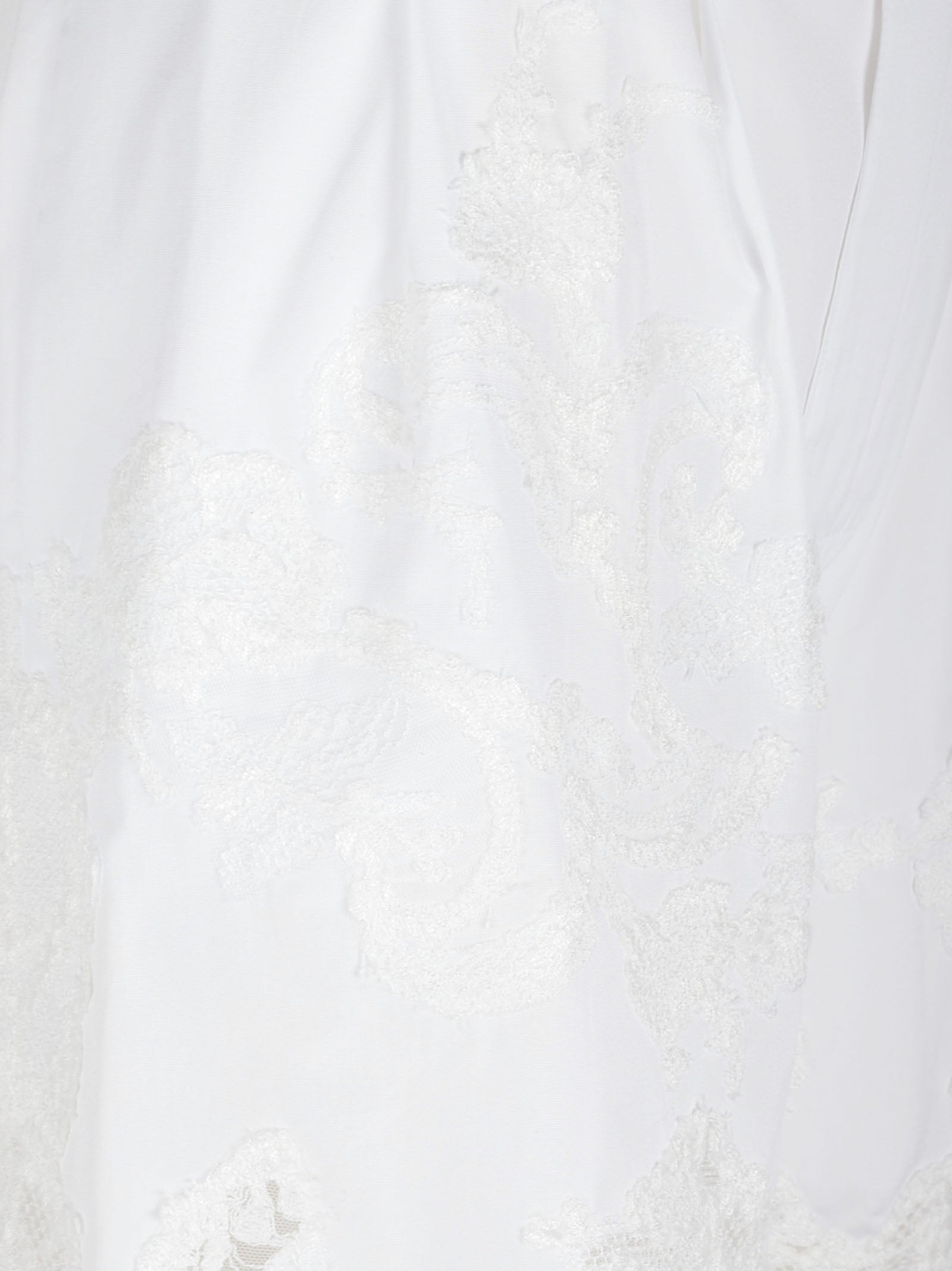 Lace-Overlay White Shorts with Scalloped Hem