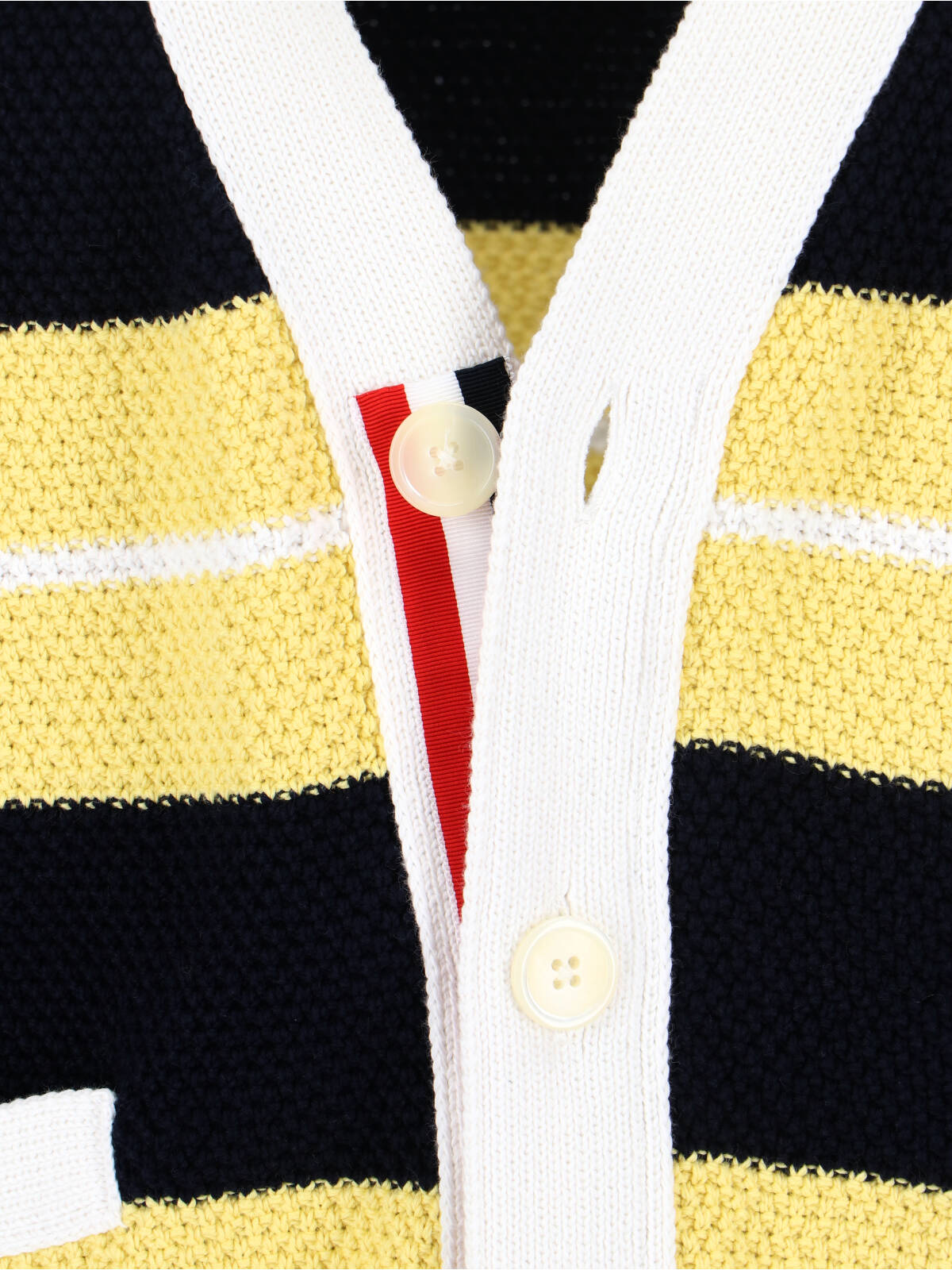 Striped Cardigan – Yellow
