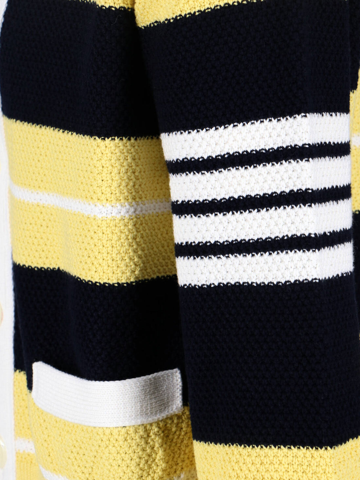 Striped Cardigan – Yellow